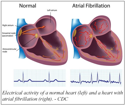 heart diagram